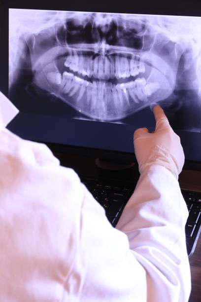 Best Knocked-Out Tooth Emergency  in Mckinley, PA